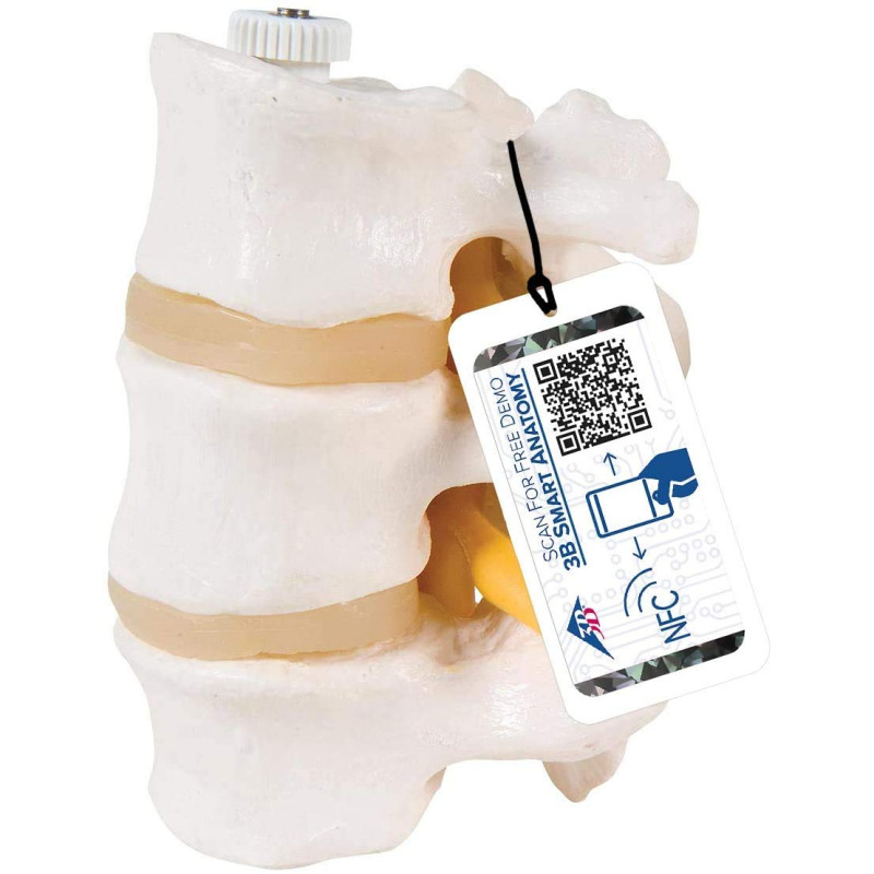 3B Scientific® Modèle de 3 Vertèbres Lombaires – Segment Vertébral Taille Réelle avec Disques Intervertébraux, Montage Flexible 