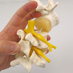 3B Scientific® Modèle de 3 Vertèbres Lombaires – Segment Vertébral Taille Réelle avec Disques Intervertébraux, Montage Flexible