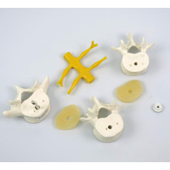 3B Scientific® Modèle de 3 Vertèbres Lombaires – Segment Vertébral Taille Réelle avec Disques Intervertébraux, Montage Flexible 