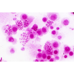 Bresser 30 préparations microscope (Histologie)