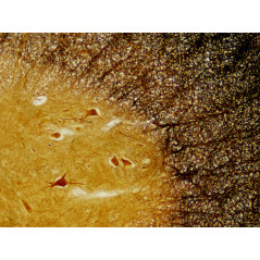 Bresser 30 préparations microscope (Histologie)