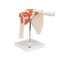 3B Scientific® Articulation Fonctionnelle de l’Épaule Humaine – Muscles de la Coiffe des Rotateurs, Mouvement Complet (Abduction 3B Scientific® Articulation Fonctionnelle de l’Épaule Humaine – Muscles de la Coiffe des Rotateurs, Mouvement Complet (Abduction