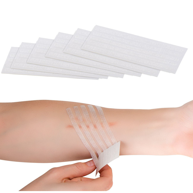 30 bandes de suture rapide -102 x 6 mm [Newgen Medicals]